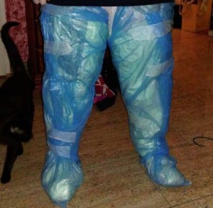 Calf Liposuction