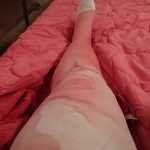 Lying in bed in the hotel