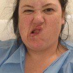 Funny faces in the recovery room