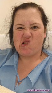 Funny faces in the recovery room