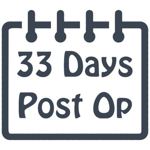 Calf Liposuction Surgery 33 Days Post Op