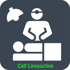 Calf Liposuction Surgery Day