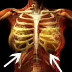 Bruised ribs from cannula