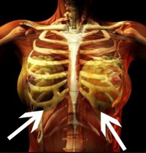 Bruised ribs from cannula