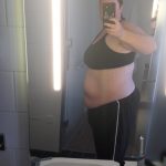 Before 7th liposuction - right side