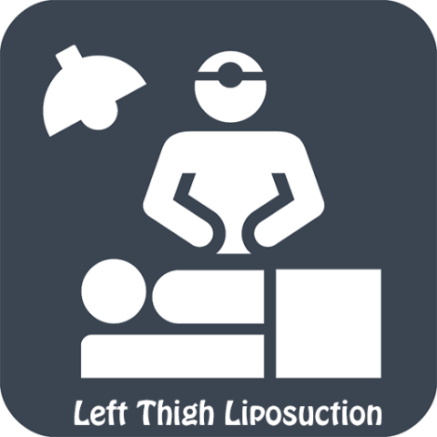 Left Thigh Liposuction - Surgery Day